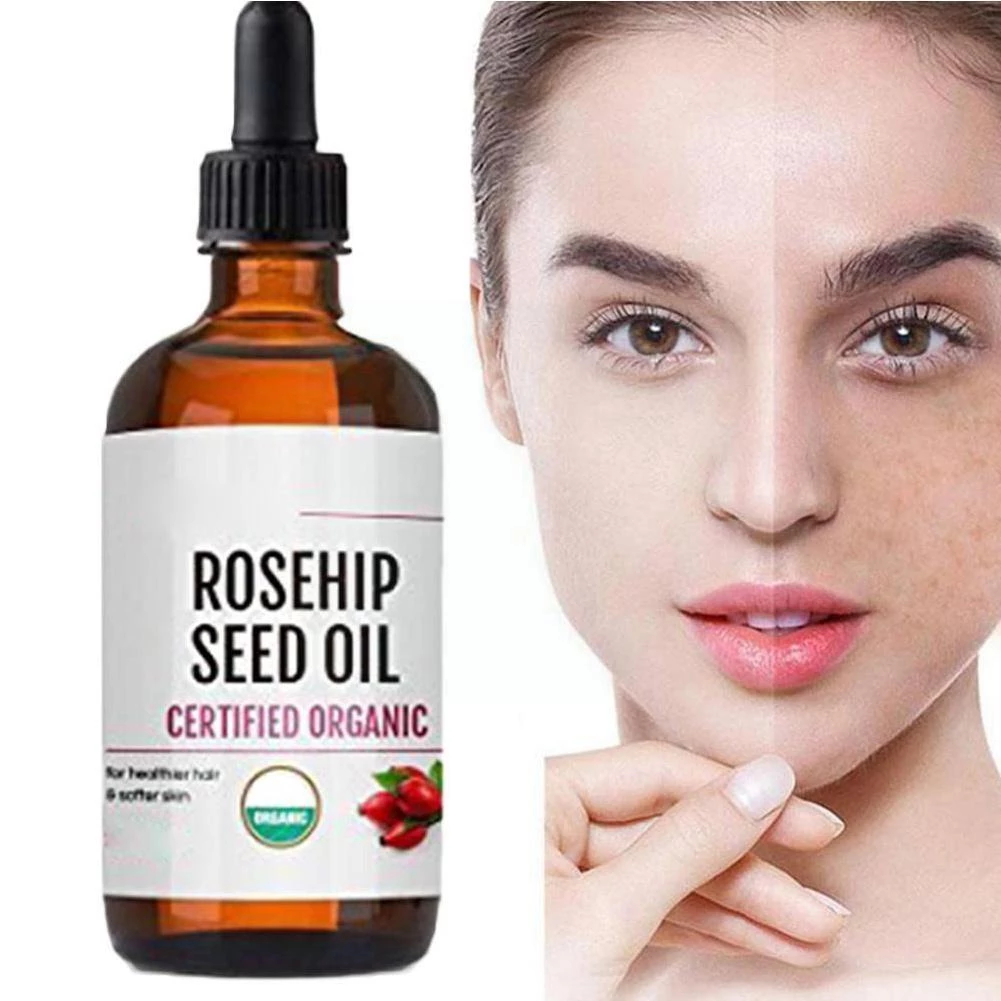 Aceites esenciales puros de 100%, aceite de Rosa HIP